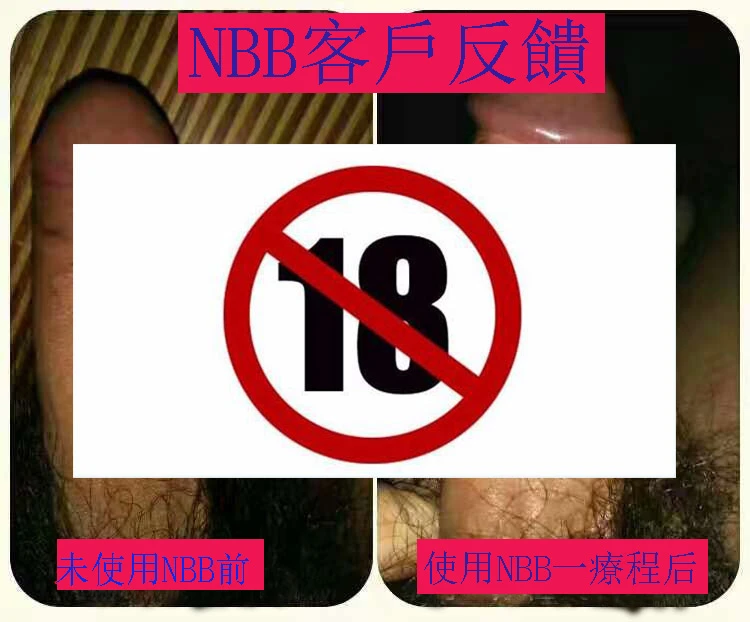 NBB修護膏產品示意圖